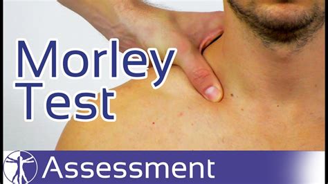 scalene compression test|brachial plexus tests.